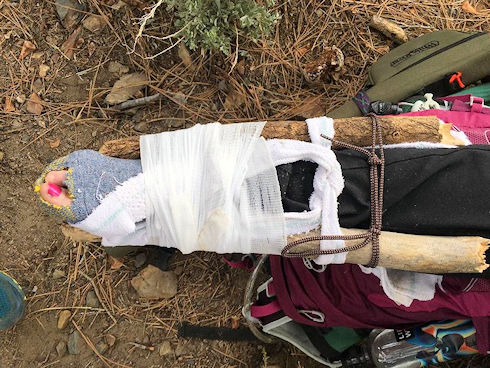 The Jeffrey Pine splint applied by the subject’s hiking companions. Image by M. Quiring